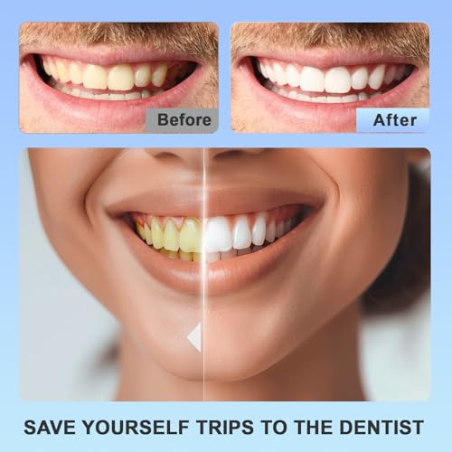 Teeth Whitening Strips 14 Treatments Kit - For Teeth Whitening , Deep Stains Removal, Carefully Designed Whitening Strips, Allowing You To Have a Brighter Smile(28 Pcs)-The Hypothesis of Love 1