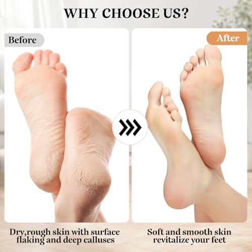 Electric Callus Remover Foot File - Rechargeable Callus Remover Pedicure Tools for Feet Foot Scrubber File Foot Care Grinder with 3 Grinding Heads 2 Speeds for Men Women Dry Callus Dead Skin (Orange)