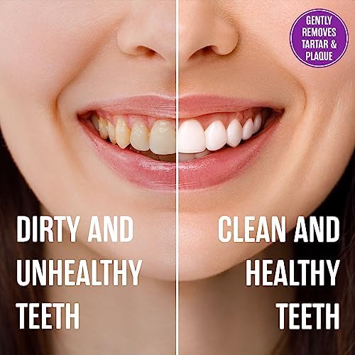 SprinJene Natural Sensitivity & Gum, Fluoride Free Toothpaste for Strong Teeth & Gums - Natural Toothpaste to Soothe Dry Mouth & Freshen Breath | 2 Pack
