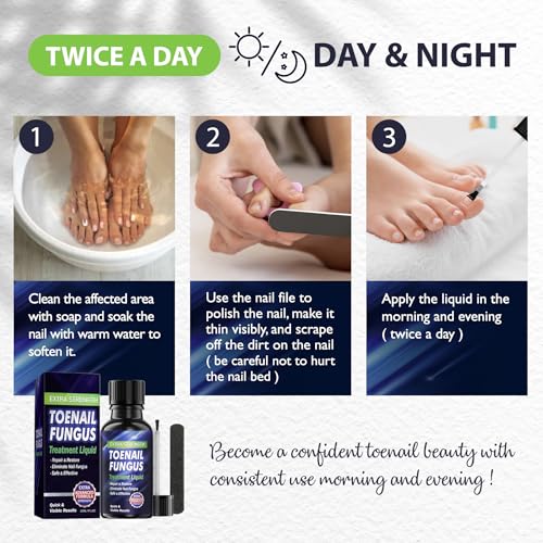 Toenail Fungus Treatment Extra Strength, Toe Fungus Treatment for Toenail, Fungus Nail Treatment, Nail Fungus Treatment for Damaged Nail & Athletes Foot (1oz)