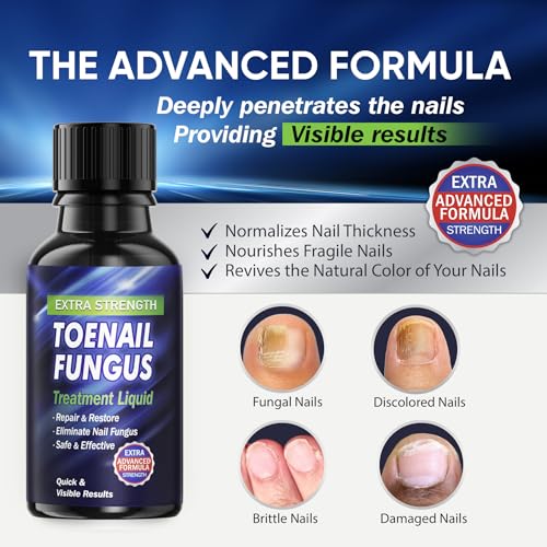 Toenail Fungus Treatment Extra Strength, Toe Fungus Treatment for Toenail, Fungus Nail Treatment, Nail Fungus Treatment for Damaged Nail & Athletes Foot (1oz)