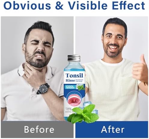 Tonsil Stone Remover, Nature Tonsil Stone Mouthwash or Oral Rinse Liquid to Remove Bad Breath, Soothe Dry Mouth & Fresh Breath, Tonsil Stone Removal Liquid, 4Fl Oz