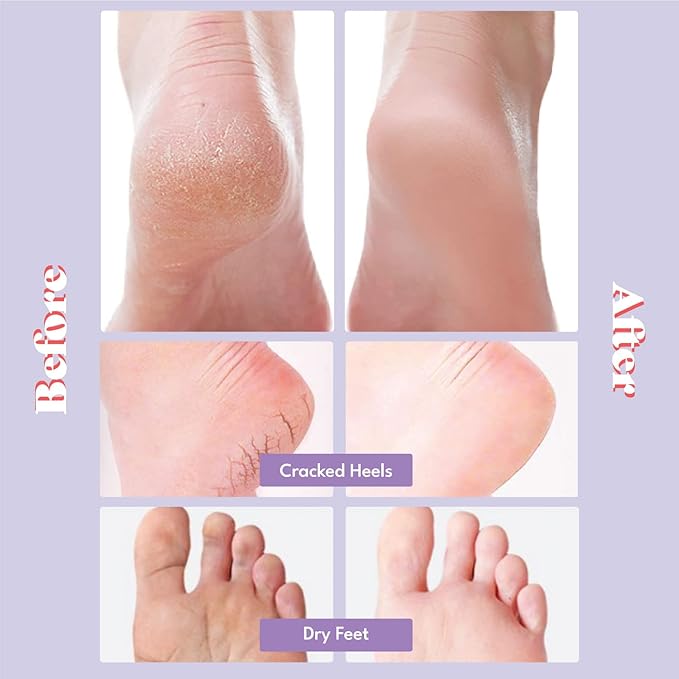 Extra Silky Foot Mask 5 Pairs, Post-Peeling Foot Care Treatment, Moisturizing Socks with Guerande Salt & Sweet Almond Oil for Dry Feet, Cracked Heels, and Callus