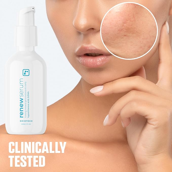 BRIOTECH Renew Serum, Hypochlorous Acid Mineral Gel, Soften Fine Line Appearance, Smooth Skin for Face, Neck, Chest, Spot Corrector, Soothe Redness, Vegan, 2 fl oz (2 Pack)