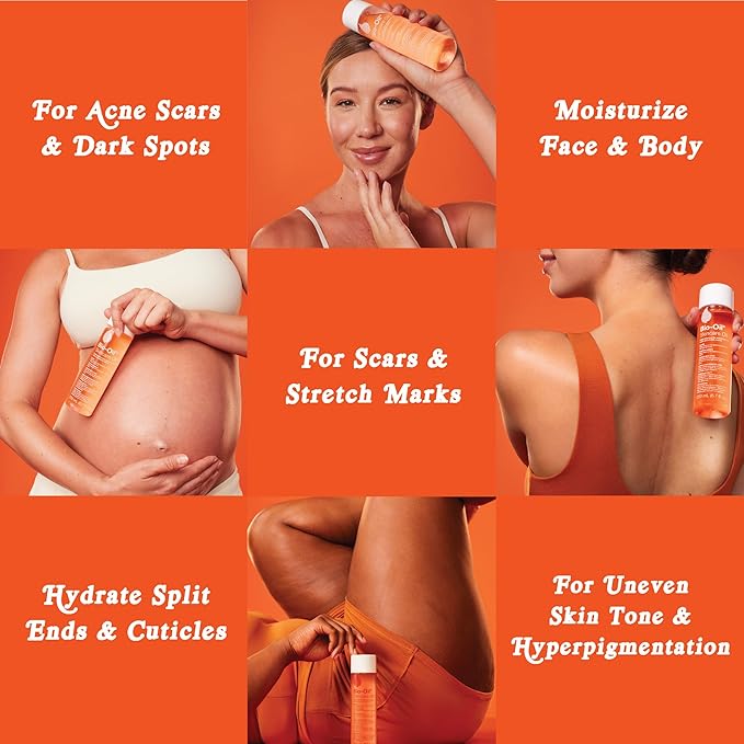 Bio-Oil Skincare Body Oil Serum, Face and Body Moisturizer with Vitamin E & A, for Scars, Stretch Marks, Sensitive Skin, All Skin Types, Dermatologist Recommended, Non-Comedogenic, 2 Oz